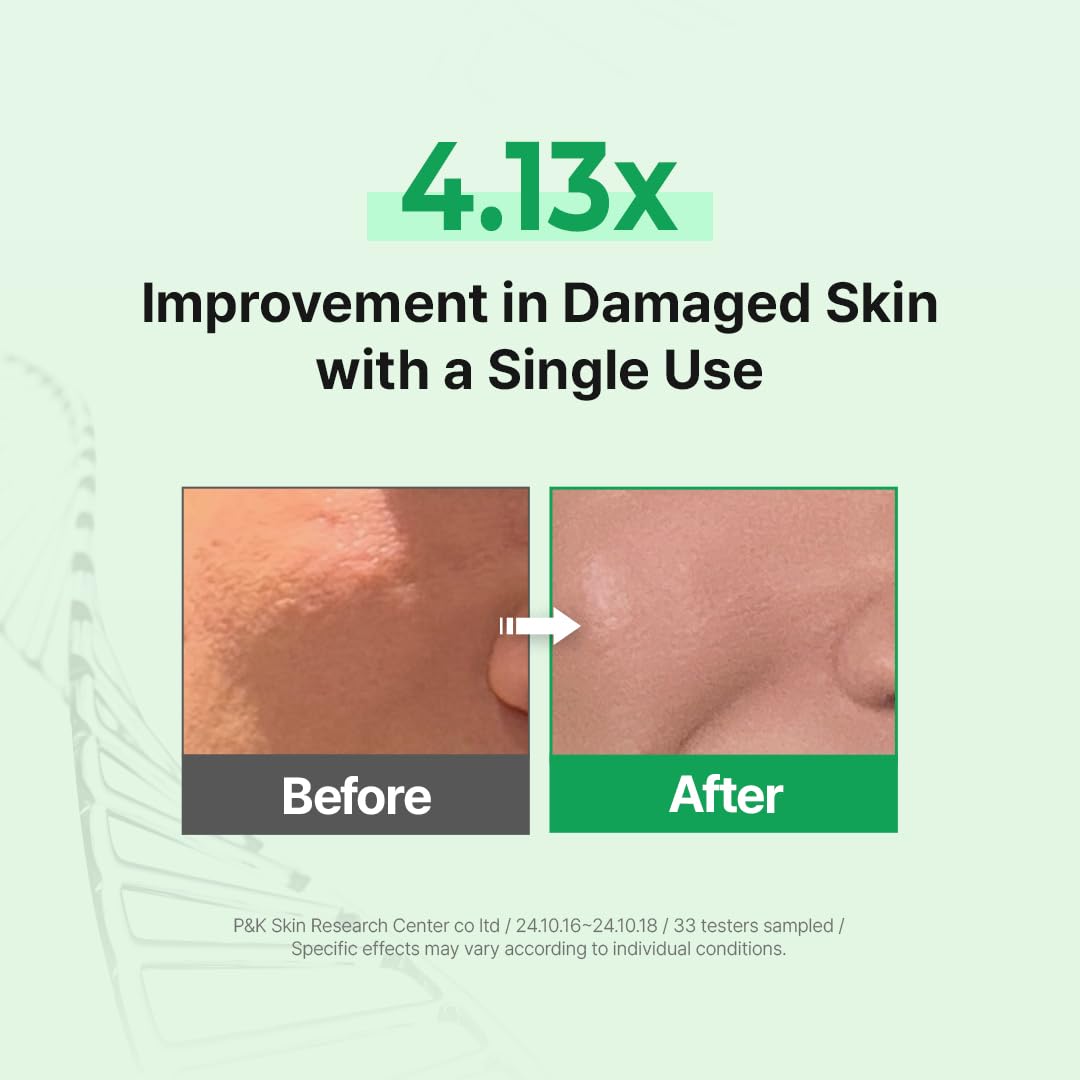 Zipiderm EGF Deep Cleansing Foam – Korean Gentle Facial Cleanser with EGF for Sensitive & Acne-Prone Skin, Double Cleansing K-Beauty Foam that Supports Skin Barrier & Smooth Texture