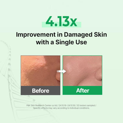 Zipiderm EGF Deep Cleansing Foam – Korean Gentle Facial Cleanser with EGF for Sensitive & Acne-Prone Skin, Double Cleansing K-Beauty Foam that Supports Skin Barrier & Smooth Texture