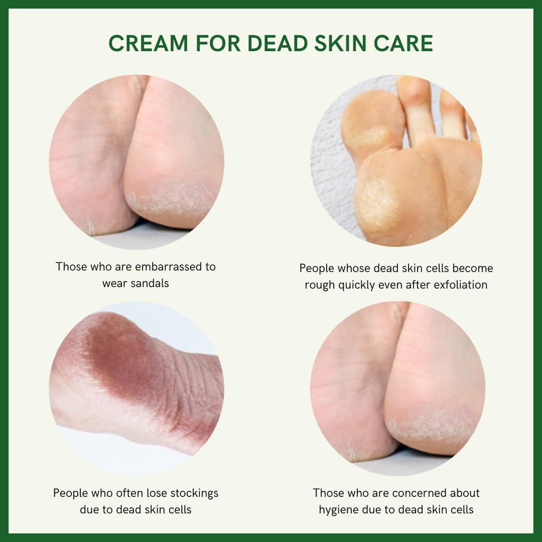 3WB Premium Foot Cream for Dry Cracked Heels Feet Knees Elbows Hands, Foot Dead Skin Cuticle Callus Remover Toenail Softener, Keratolytic Skin Barrier Repair Cream