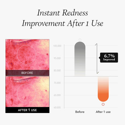 APRILSKIN Carrotene IPMP™ Instant Calming Serum Toner Pads | 5-Minute Cooling Serum Pads | Vegan, Cruelty-Free | Non-comedogenic | Toner-Serum-Sheet Mask All-in-one | Korean Skin Care, 80 Pads