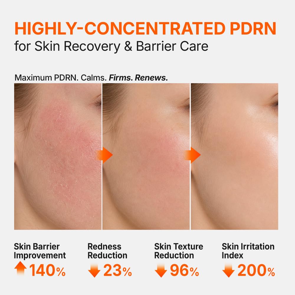 Genabelle 3% PDRN Skin Booster Ampoule, Serum - 30,000ppm Salmon DNA PDRN, 20,000ppm Panthenol, HTD-GENACOMPLEX Regeneration & Barrier Strengthening,Glass Skin Glow,Korean Skincare