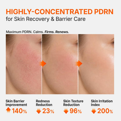 Genabelle 3% PDRN Skin Booster Ampoule, Serum - 30,000ppm Salmon DNA PDRN, 20,000ppm Panthenol, HTD-GENACOMPLEX Regeneration & Barrier Strengthening,Glass Skin Glow,Korean Skincare