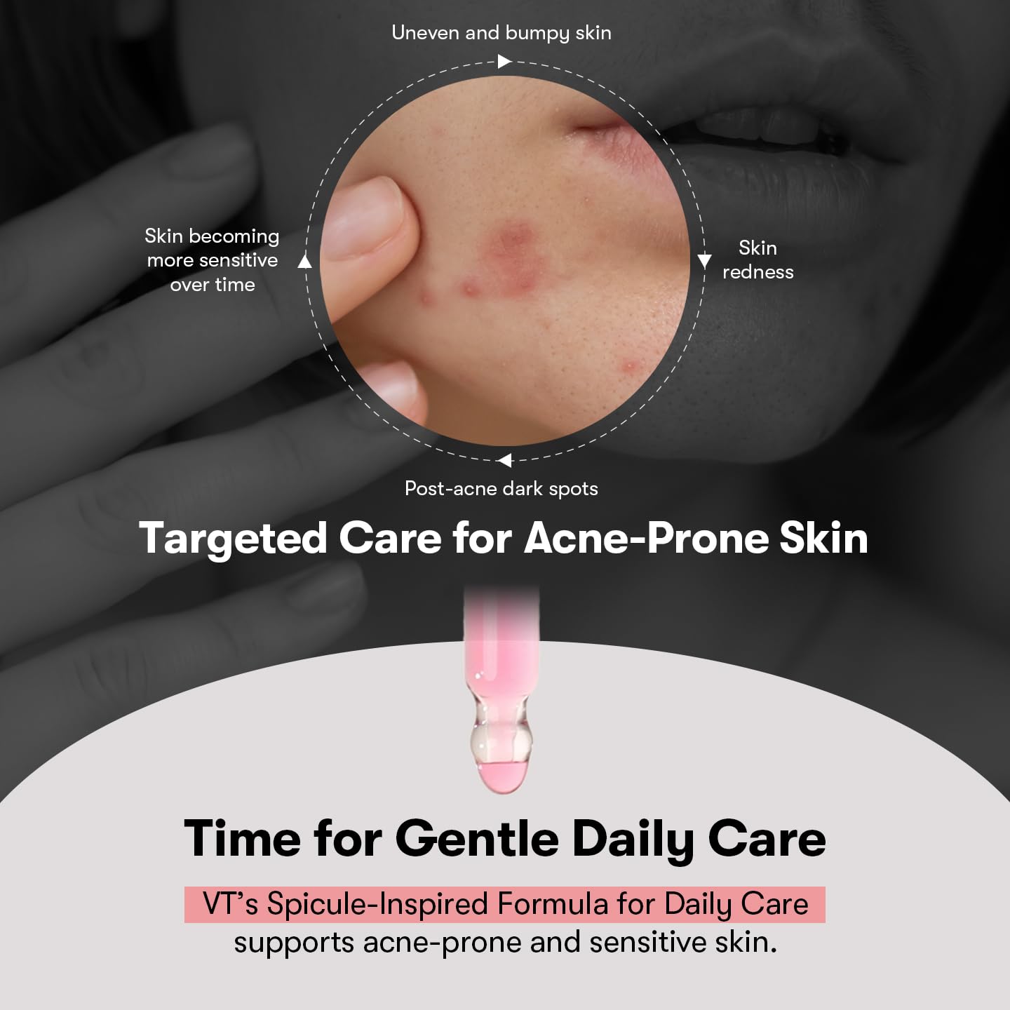 VT COSMETICS Azelaic Acid Cica Exosome Ampoule, Korean Skincare Serum