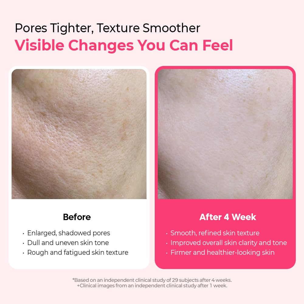 Dr.Melaxin Cyano Pink Spicule Serum with Vitamin B12, Liquid Microneedle Facial Treatment for Enlarged Pores, Niacinamide for Texture Refining & Renewal