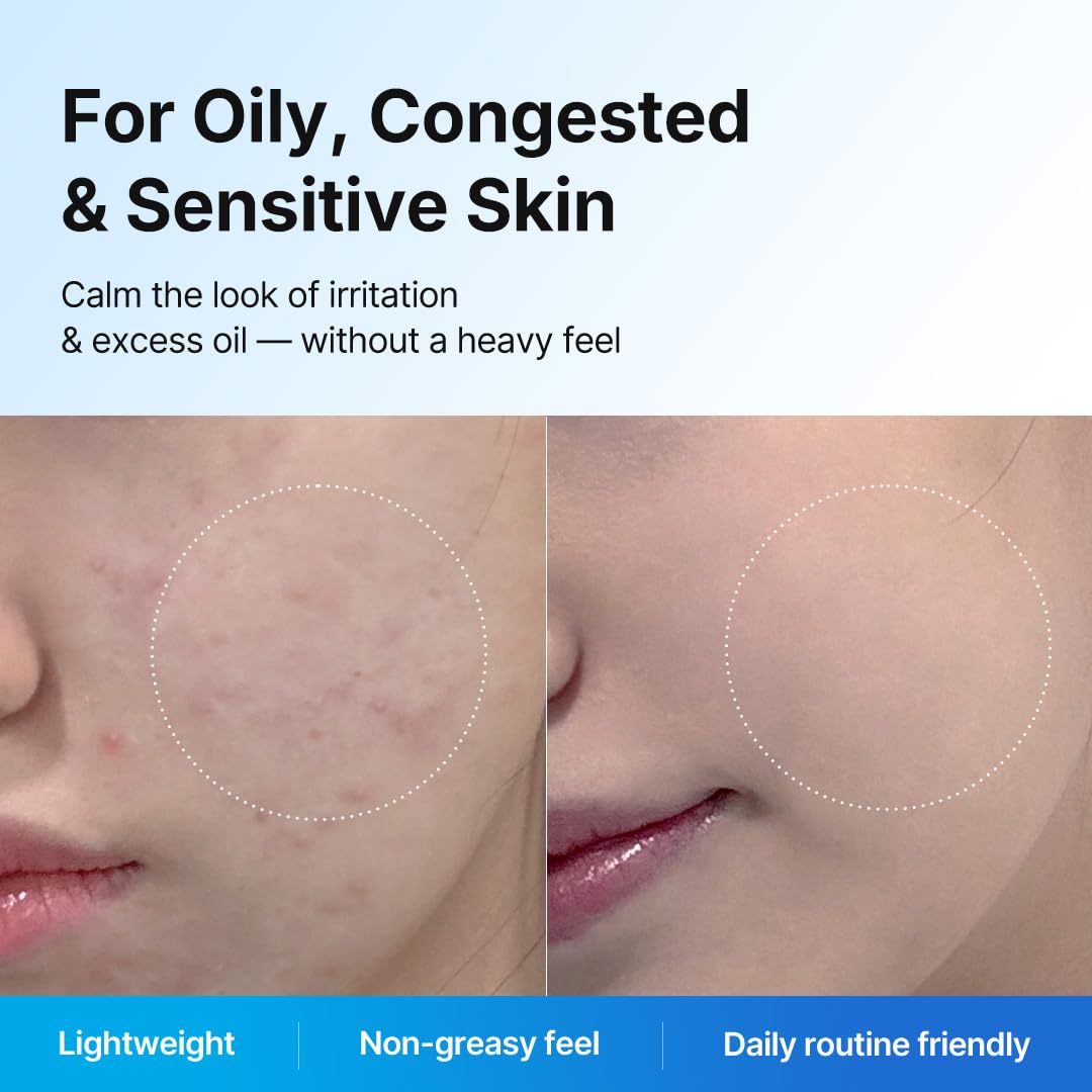 Blue Eraser Serum with Cooling LED Applicator, Tea Tree Calming Serum for Oily Skin & Sensitive Skin, Korean Skincare