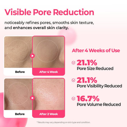 Dr.Melaxin Cyano Pink Spicule Serum with Vitamin B12, Liquid Microneedle Facial Treatment for Enlarged Pores, Niacinamide for Texture Refining & Renewal