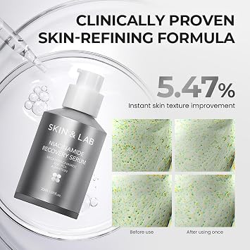[SKIN&LAB] Niacinamide Recovery Serum | Niacinamide 20% + Zinc + Allantoin | For Minimizes Pores And Improves Skin Texture | Daily Facial Essence 1.01 fl.oz