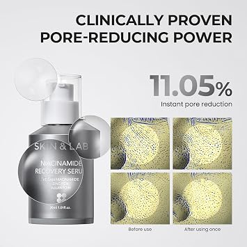 [SKIN&LAB] Niacinamide Recovery Serum | Niacinamide 20% + Zinc + Allantoin | For Minimizes Pores And Improves Skin Texture | Daily Facial Essence 1.01 fl.oz