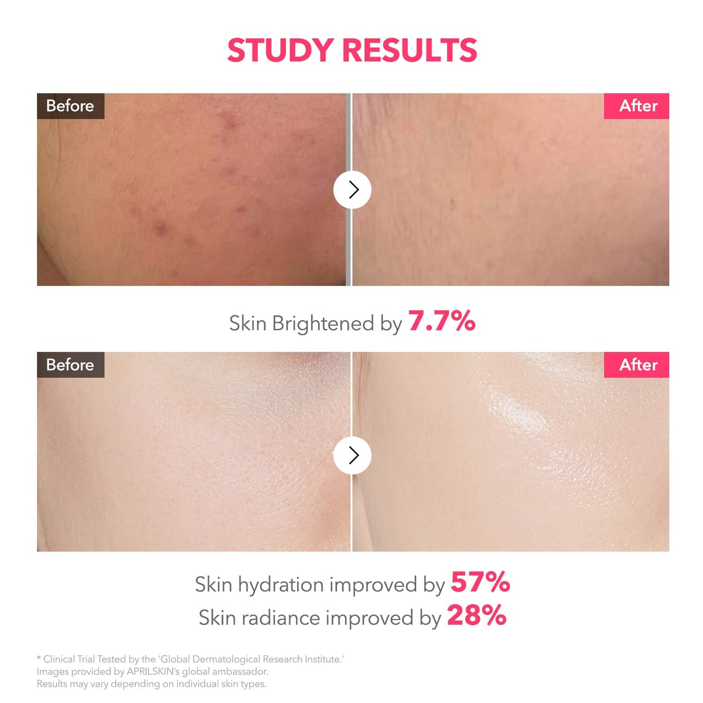 APRILSKIN TXA Pink Capsule Gel Mask (1 mask)