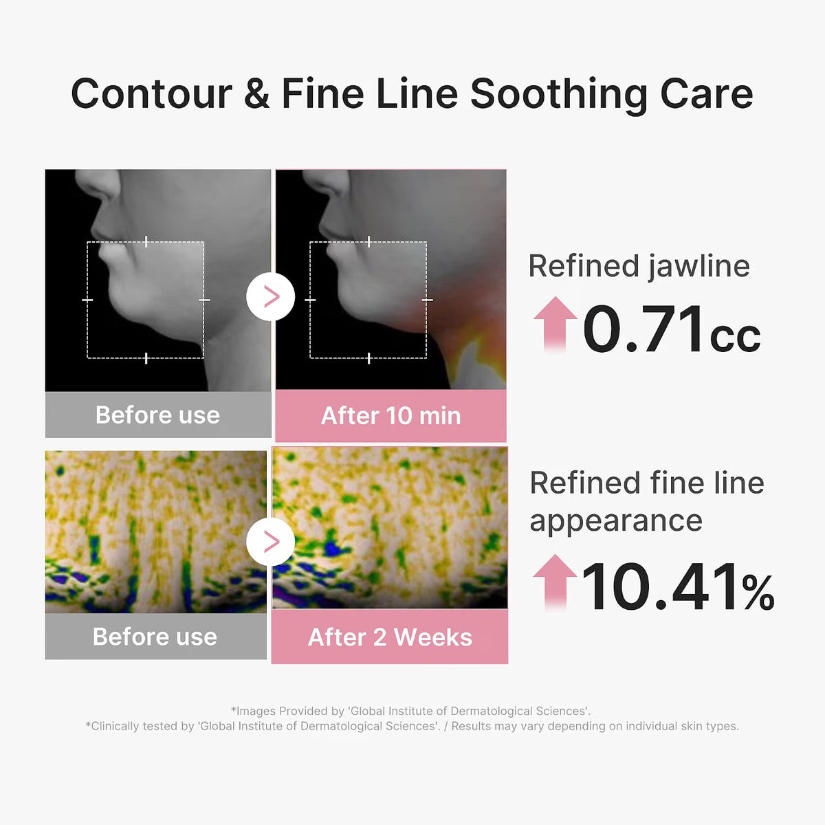 Medicube PDRN Pink Tension Up Sheet Mask (1 Mask)