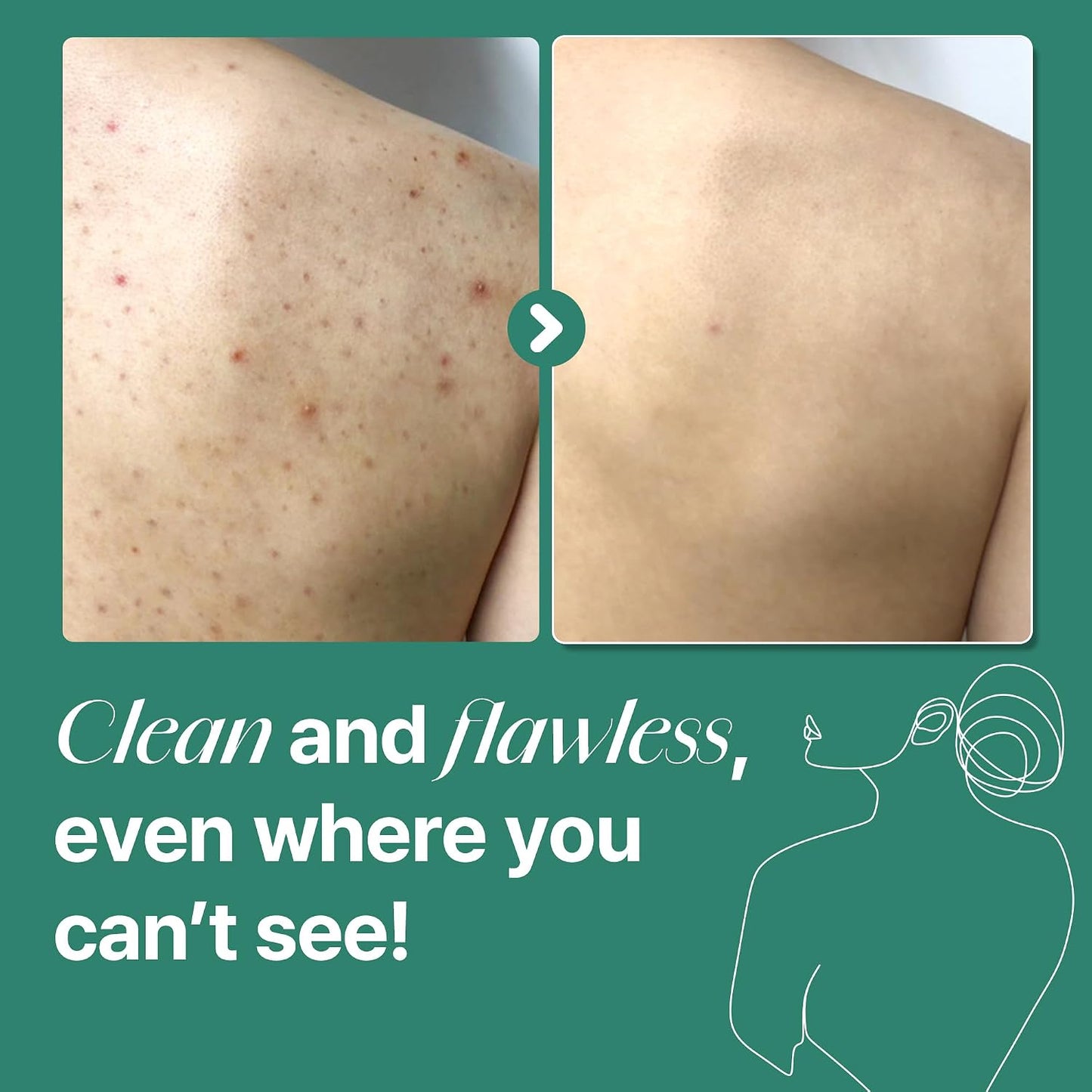 SOME BY MI AHA BHA PHA Acne Clear Body Wash- Tea Tree