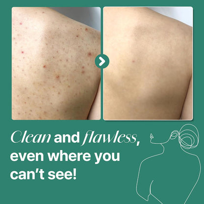 SOME BY MI AHA BHA PHA Acne Clear Body Wash- Tea Tree