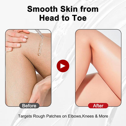 Medicube Gentle Exfoliating Serum with Hypochlorous Acid & Rice Extract - Daily Peel Solution for Smooth & Radiant Skin