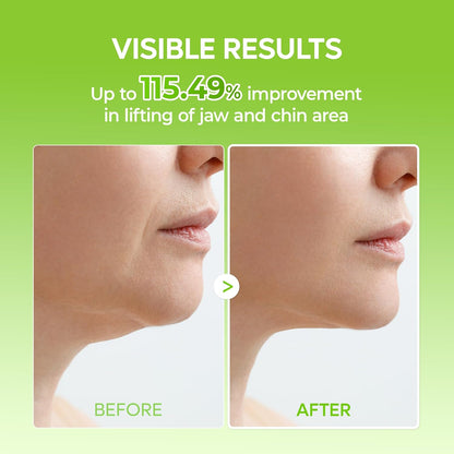 Dr.Melaxin CACTOX V-Lifting Mewing Band – Cactox + Caffeine + Collagen Double Chin Lifting Band for Sagging Jawline & Facial Puffiness, 115.49% Jaw & Chin Lifting Improvement, Korean V-Line Lifting