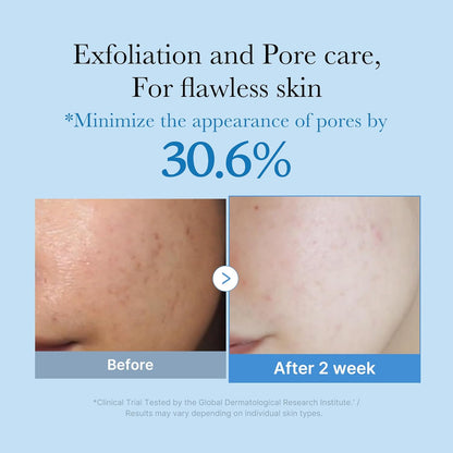 medicube Zero Pore Toner I Exfoliating & Hydrating Blue Bottle Water Toner with AHA, BHA, PHA, Niacinamide, and Panthenol | Korean Skin Care for Pores, Texture, and Moisture Care