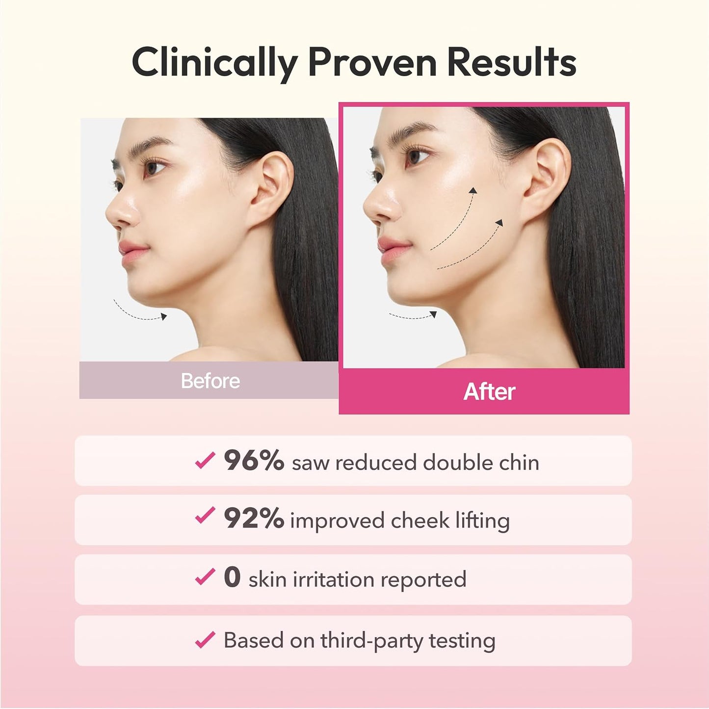 V-Line Lifting Mask – Reduce Double Chin, Firm & Tighten, 1 pack (2 mask), Jawline Mask with Volufiline™ & Bodyfit™, Hyaluronic Acid & Aloe
