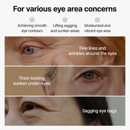 Dr.Melaxin Calcium Bonding Eye Cream with Peptides & Rebornic, Firming Eye Treatment for Wrinkles & Puffy Eyes, Elastin for Dark Circles & Hydrating Care