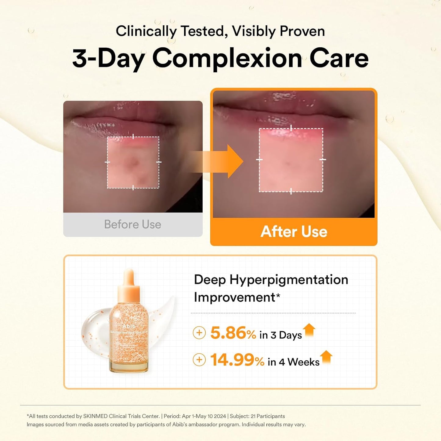 Abib Glutathiosome Dark Spot Serum Vita drop, Korean Skincare, Dark Spot, Hyperpigmentation Treatment, Lightweight, Hydrating Serum for Sensitive, Uneven Skin