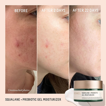 Biossance Squalane + Probiotic Balancing Face Gel Moisturizer - Advanced Formula for Oily & Acne-Prone Skin, Encapsulated Probiotics, Reduces Redness & Excess Oil, Soothes Sensitive Skin