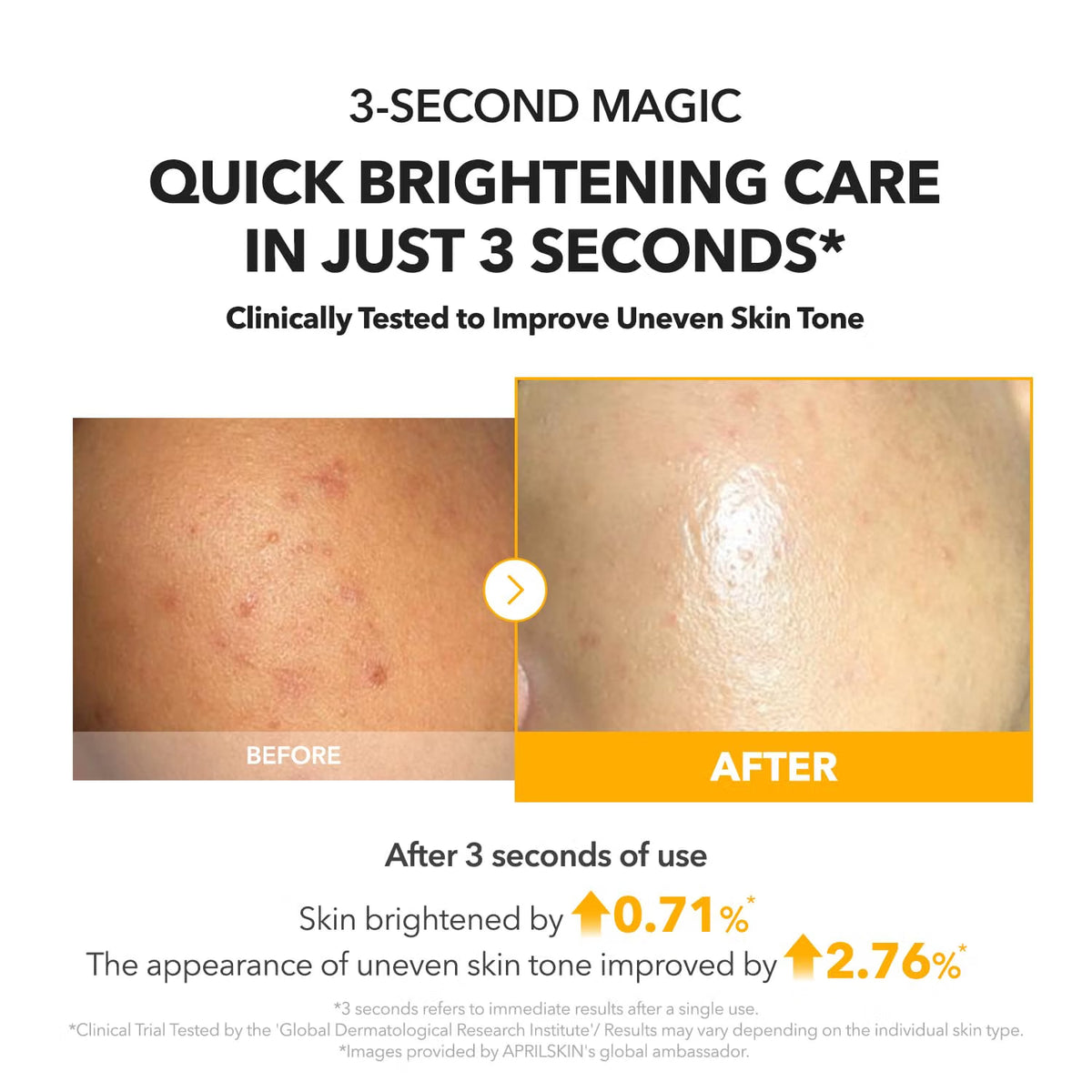 APRILSKIN A.C.E Vita Kojic Serum
