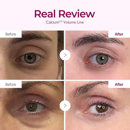 Dr.Melaxin Calcium Intense Firming Cream with Collagen & Elastin, Lifting & Volumizing Face Cream for Sagging Skin, Niacinamide for Plumping Care