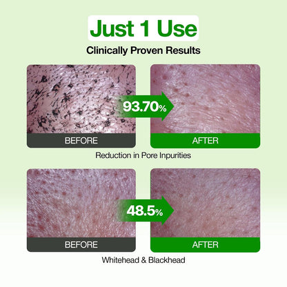 FULLY Green Tomato Pore Clay Mask Cleanser for Deep Cleansing, Clay Pack Cleanser for Deep Pore Cleansing, Blackhead & Sebum Control, Gentle Korean Face Wash for Oily & Combination Skin