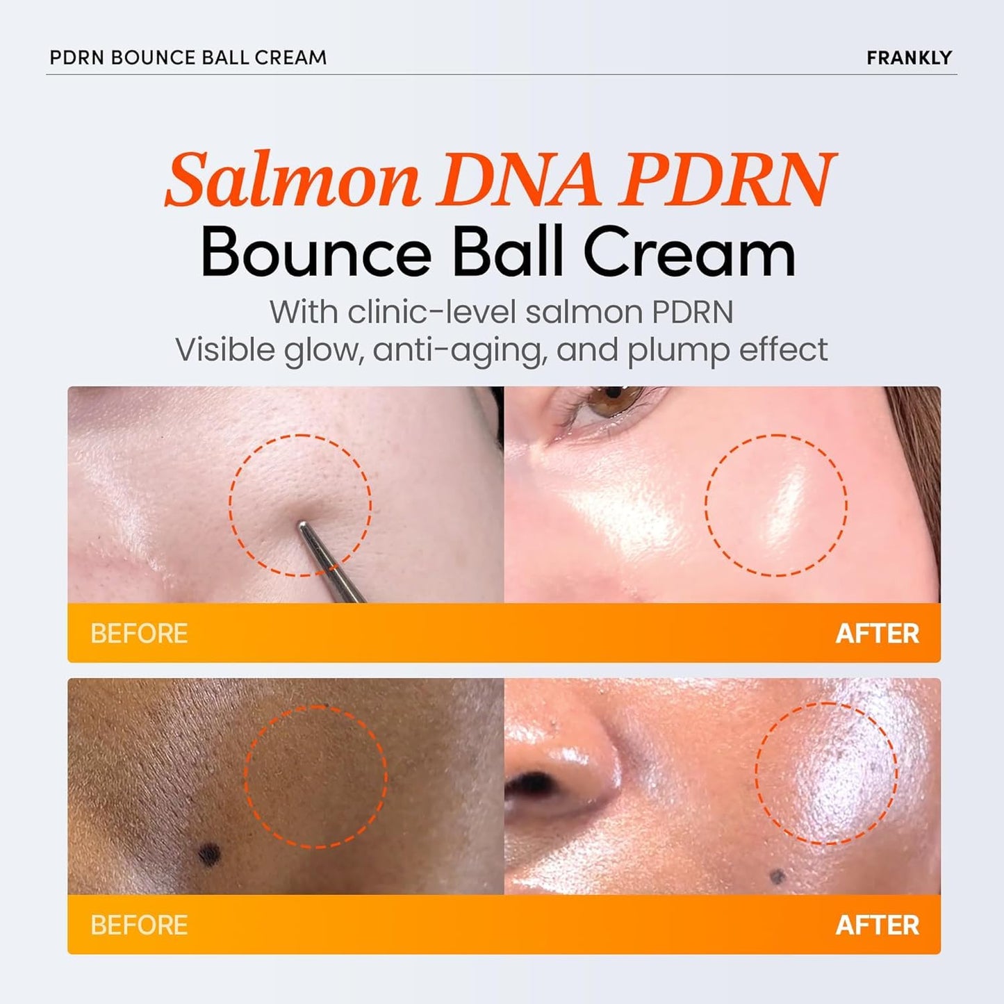 FRANKLY Salmon PDRN Bounce Ball Cream – 99% Pure Salmon DNA Moisturizer for Skin Repair & Glow | Post Microneedling Recovery & Barrier Repair | Lightweight Gel Cream | Korean Skincare