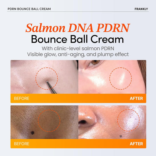 FRANKLY Salmon PDRN Bounce Ball Cream – 99% Pure Salmon DNA Moisturizer for Skin Repair & Glow | Post Microneedling Recovery & Barrier Repair | Lightweight Gel Cream | Korean Skincare