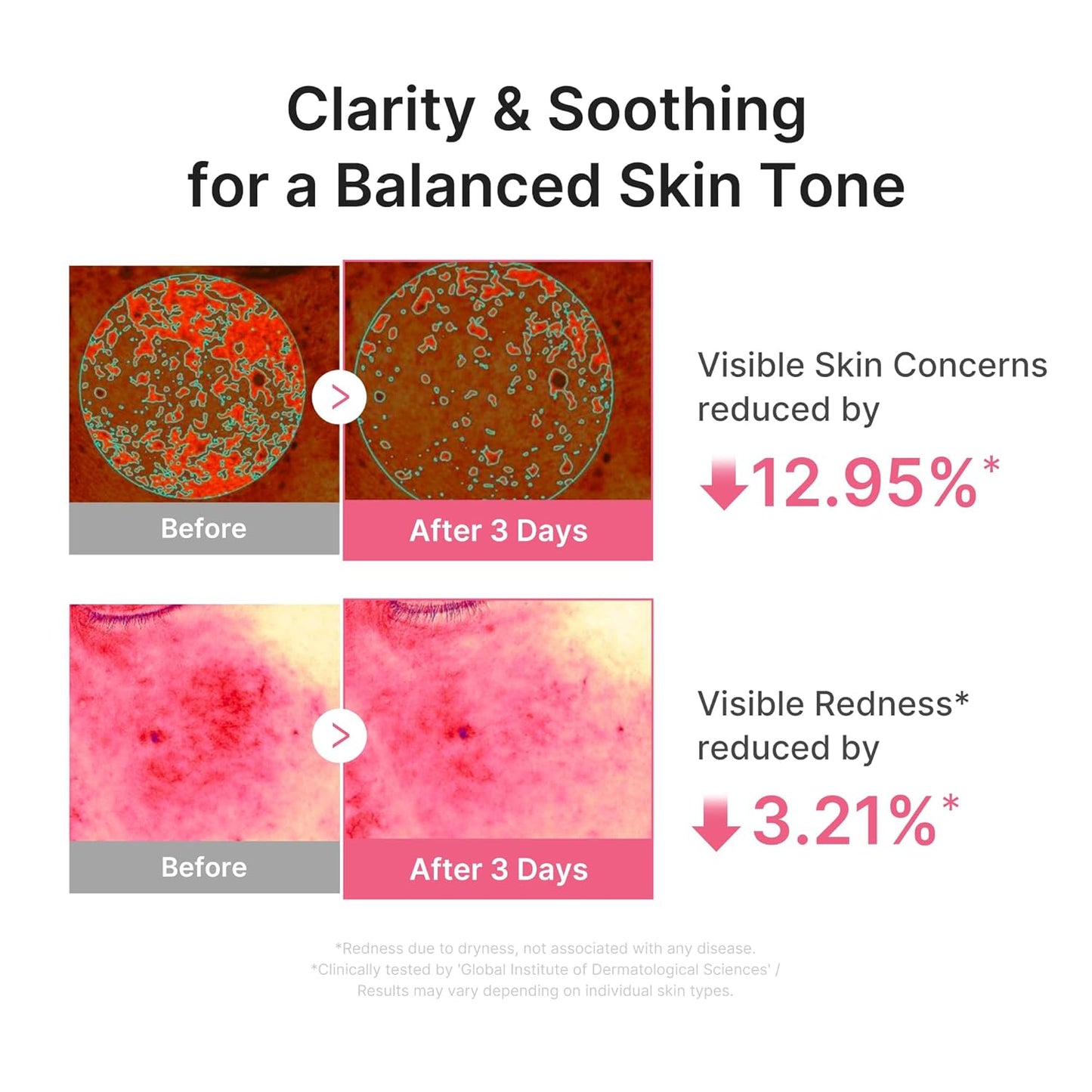 medicube PDRN Pink Peptide Serum with Salmon DNA | Ultra Light Hydrating Serum with Hyaluronic Acid | Fast-Absorbing Glow Care for Skin Clarity | Korean Skincare