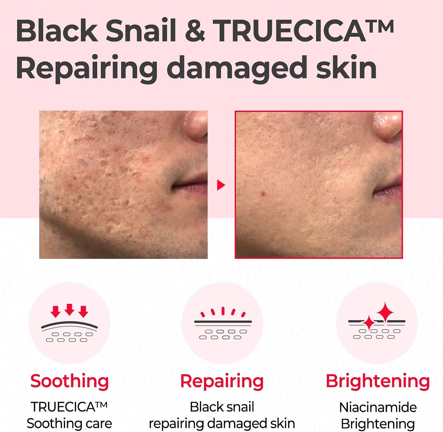SOME BY MI Snail Truecica Miracle Repair Toner - Made from Snail Mucin for Sensitive Skin, Daily Repair Face Toner with Skin Texture and Pigmentation Care, Korean Skin Care
