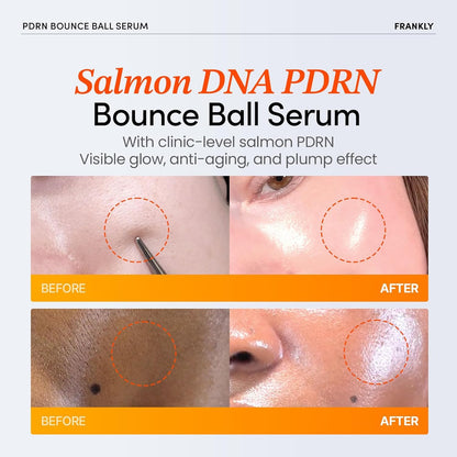 FRANKLY Salmon PDRN Bounce Ball Serum – 99% Pure Salmon DNA PDRN for Post Microneedling Recovery, Redness & Damaged Skin Repair | Glass Skin Korean Skincare | Lightweight, Non Sticky