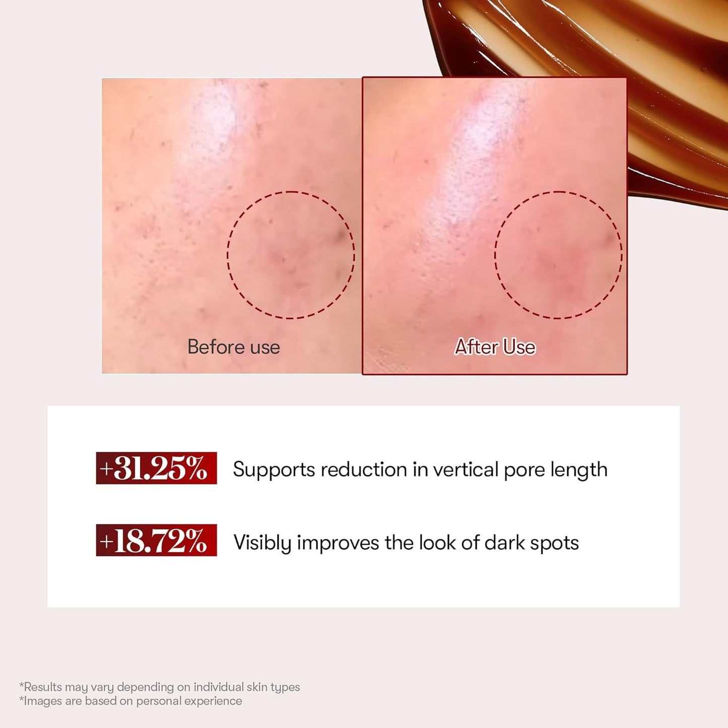 VT COSMETICS Red Booster Reedle Shot 100 Serum with Dragon’s Blood Extract & Exosome Microneedling Formula, Korean Skincare