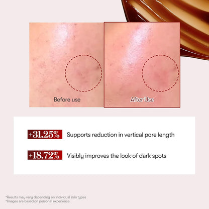 VT COSMETICS Red Booster Reedle Shot 100 Serum with Dragon’s Blood Extract & Exosome Microneedling Formula, Korean Skincare