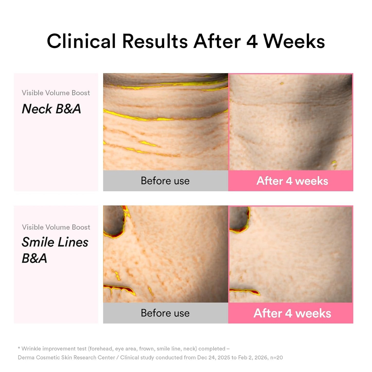 Abib PDRN Volume fill-it Booster Cream 2.5 tube | Facial Volume Plumping with PDRN 15,000ppm Peptides Retinal | For Forehead, Smile Lines & Neck Wrinkles | Anti-Aging Firming