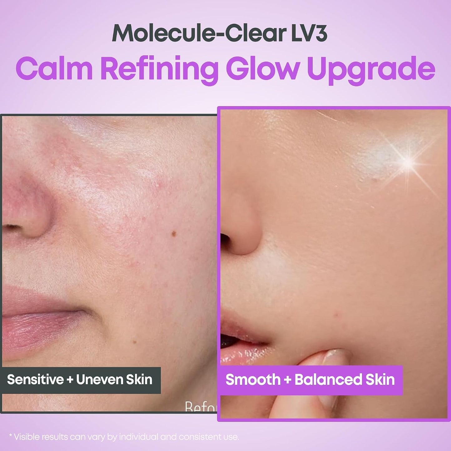 NINELESS Molecule-Clear 5% Mandelic Acid Serum, AHA Exfoliating