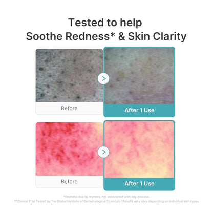 medicube Facial Cleanser Azelaic Acid Capsule Foam Cleanser | Soothing Daily Cleansing Foam For Troubled Skin & Excess Sebum Control | Uneven Skin with Niacinamide, Glycerin | Korean Skincare
