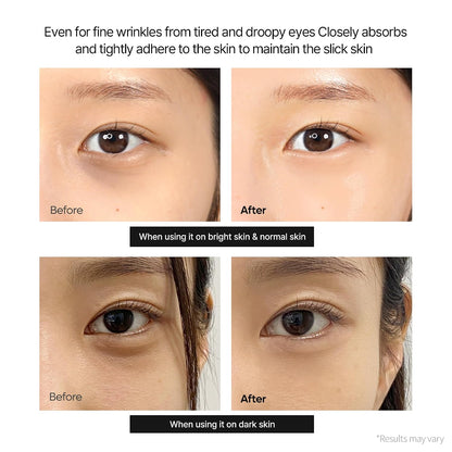 Dr.Melaxin Calcium Dark Spot Eye Cream – Niacinamide & Calcium Gluconate Eye Cream for Dark Circles, Under Eye Bags & Sagging | Hydrolyzed Elastin EX Volume Firming | Korean Eye Cream