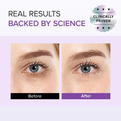 Mary&May Tranexamic Acid + Glutathione Eye Cream (30g) - Korean Skincare for Dark Circles & Uneven tone - Fragrance-Free Under Eye Cream for Dark Spots & Hyperpigmentation