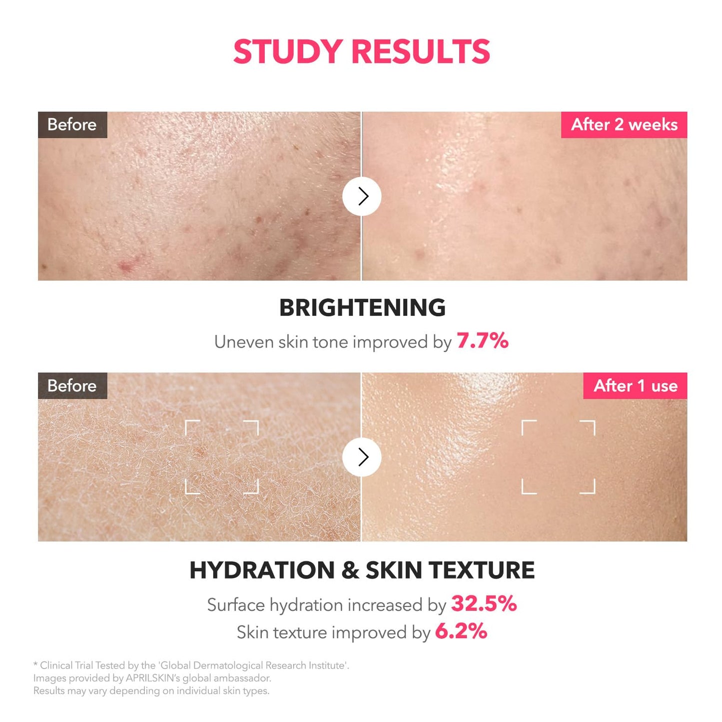 APRILSKIN TXA + Niacinamide 99 Pink Milky Toner, 99% High-Purity TXA 3%+ Niacinamide 5% for Brightening, Highly Concentrated Cream Toner, Deep Moisturizing Formula for Dull Skin