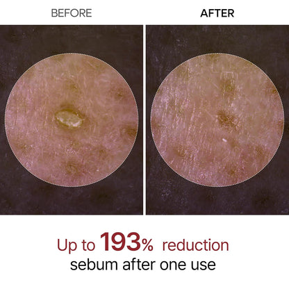 Dr.Melaxin Peel Shot Glow White Rice Peeling Ampoule with Rice Extract & AHA BHA, Brightening & Gentle Exfoliating Serum for Sebum Control, Niacinamide & Hyaluronic Acid, Korean Skincare