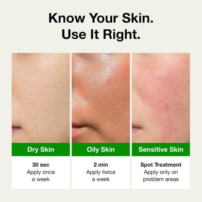 FULLY Green Tomato Pore Clay Mask Cleanser for Deep Cleansing, Clay Pack Cleanser for Deep Pore Cleansing, Blackhead & Sebum Control, Gentle Korean Face Wash for Oily & Combination Skin