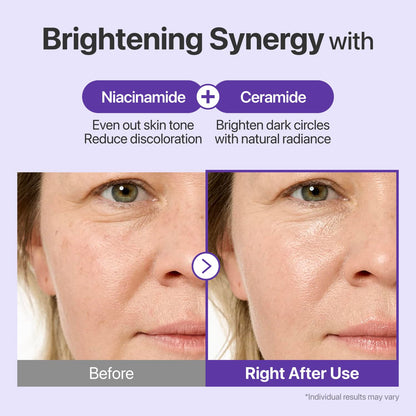 numbuzin No.9 NAD+ Retinal Volumetox Eye Cream, Anti-Aging Treatment for Wrinkles, Fine Lines, Dark Circles & Dark Spots, Gentle Retinal Formula with Peptides & Niacinamide