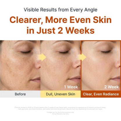 SUNGBOON EDITOR Glow Intensive Kojic Acid Ampoule, Turmeric & PHA