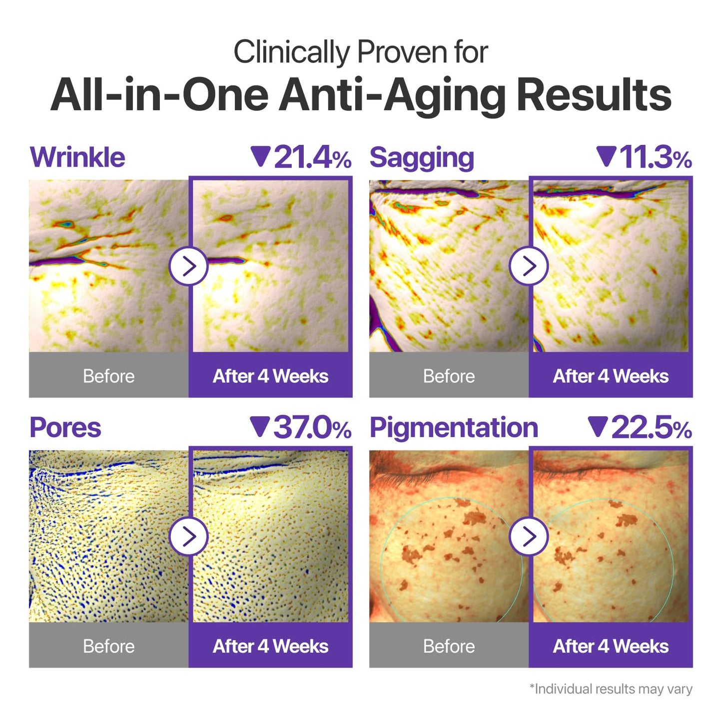 numbuzin No.9 NAD+ Retinal Volumetox Eye Cream, Anti-Aging Treatment for Wrinkles, Fine Lines, Dark Circles & Dark Spots, Gentle Retinal Formula with Peptides & Niacinamide