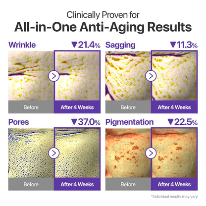 numbuzin No.9 NAD+ Retinal Volumetox Eye Cream, Anti-Aging Treatment for Wrinkles, Fine Lines, Dark Circles & Dark Spots, Gentle Retinal Formula with Peptides & Niacinamide
