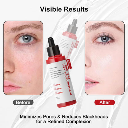 Medicube Gentle Exfoliating Serum with Hypochlorous Acid & Rice Extract - Daily Peel Solution for Smooth & Radiant Skin