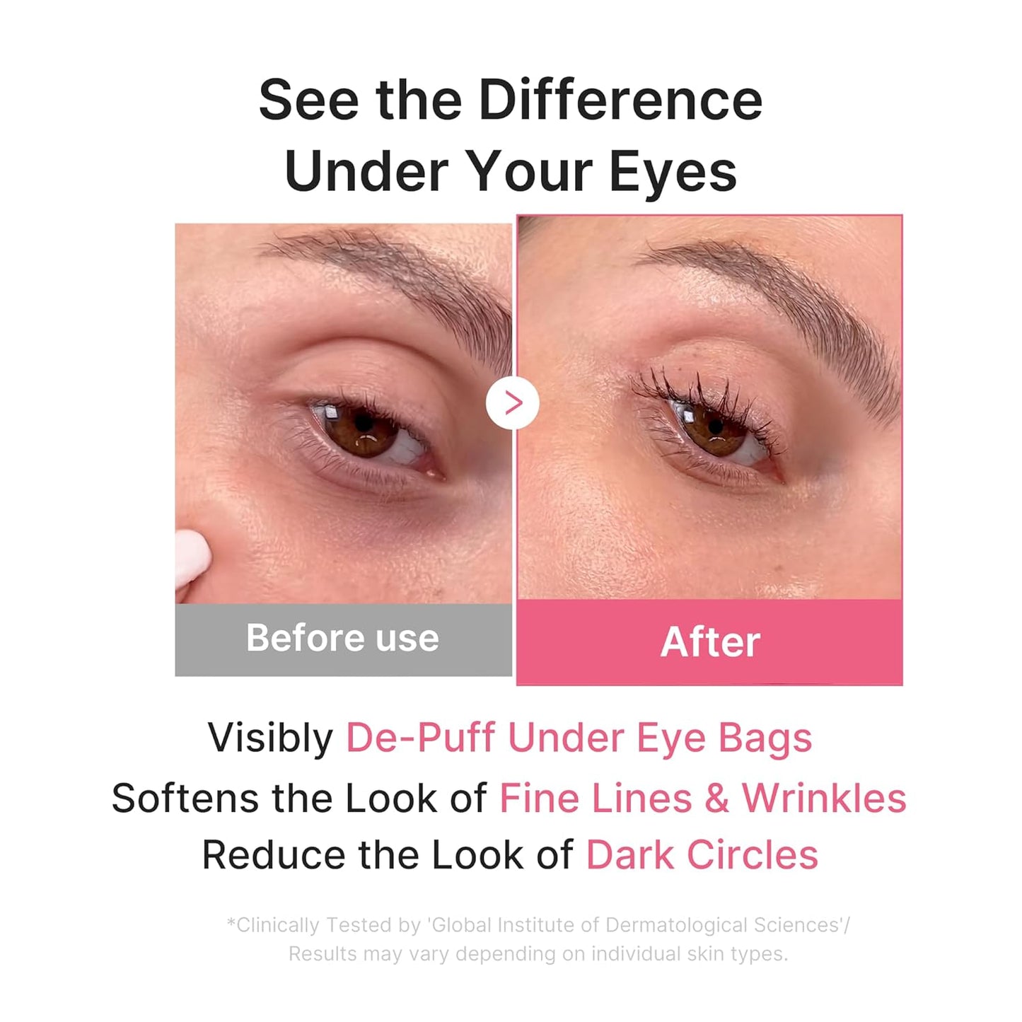 medicube PDRN Pink Collagen Jelly Eye Mask - One (1) Pair, Hydrogel Eye Patches with PDRN, Collagen, NAD, Refreshing for Puffy, Tired Eyes, Firming for Look of Wrinkles, Fine Lines, Korean Skincare