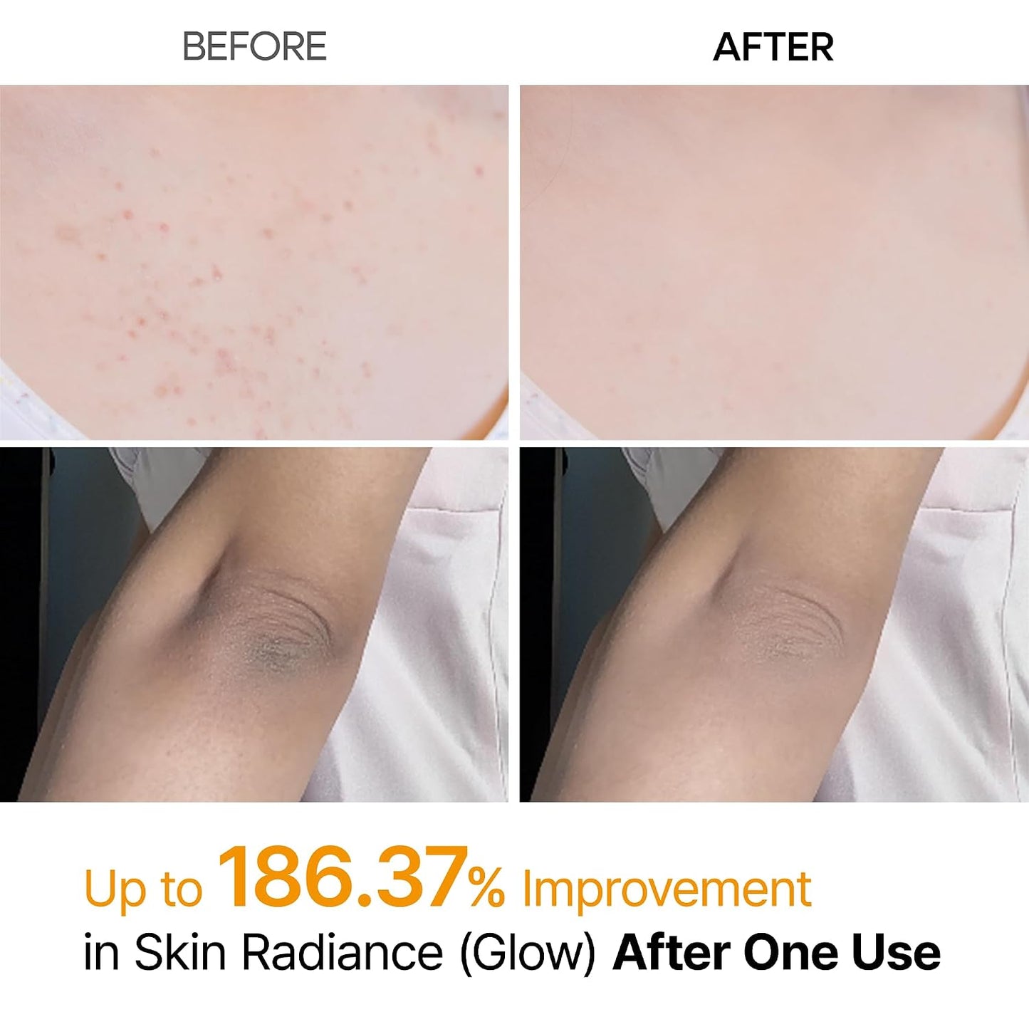 Dr.Melaxin Peel Shot Kojic Acid Turmeric Body Exfoliator Spray 6.76 fl.oz - AHA PHA Niacinamide Body Scrub for KP Bumps, Dark Spots, Uneven Skin Tone, Dead Skin, Korean Skin Care