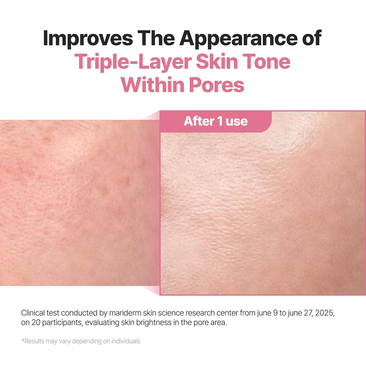 P.CALM Red Rice Bubble Deep Mask