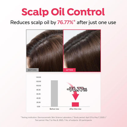 A'PIEU Raspberry Hair Vinegar Rinse, Scalp Cleanser for Dandruff, Buildup & Excess Oil, Smooth & Shiny Hair, Itchy Scalp Relief, pH Balancing, Fresh Raspberry Scent, Korean Haircare